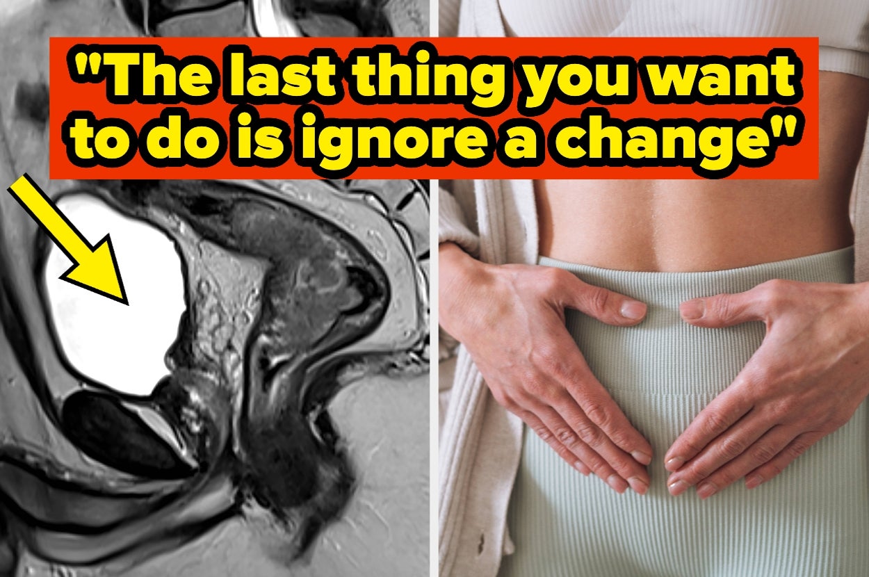 Doctors Are Warning That This 1 "Embarrassing" Symptom Could Be A Crucial Warning Sign Of Colorectal Cancer