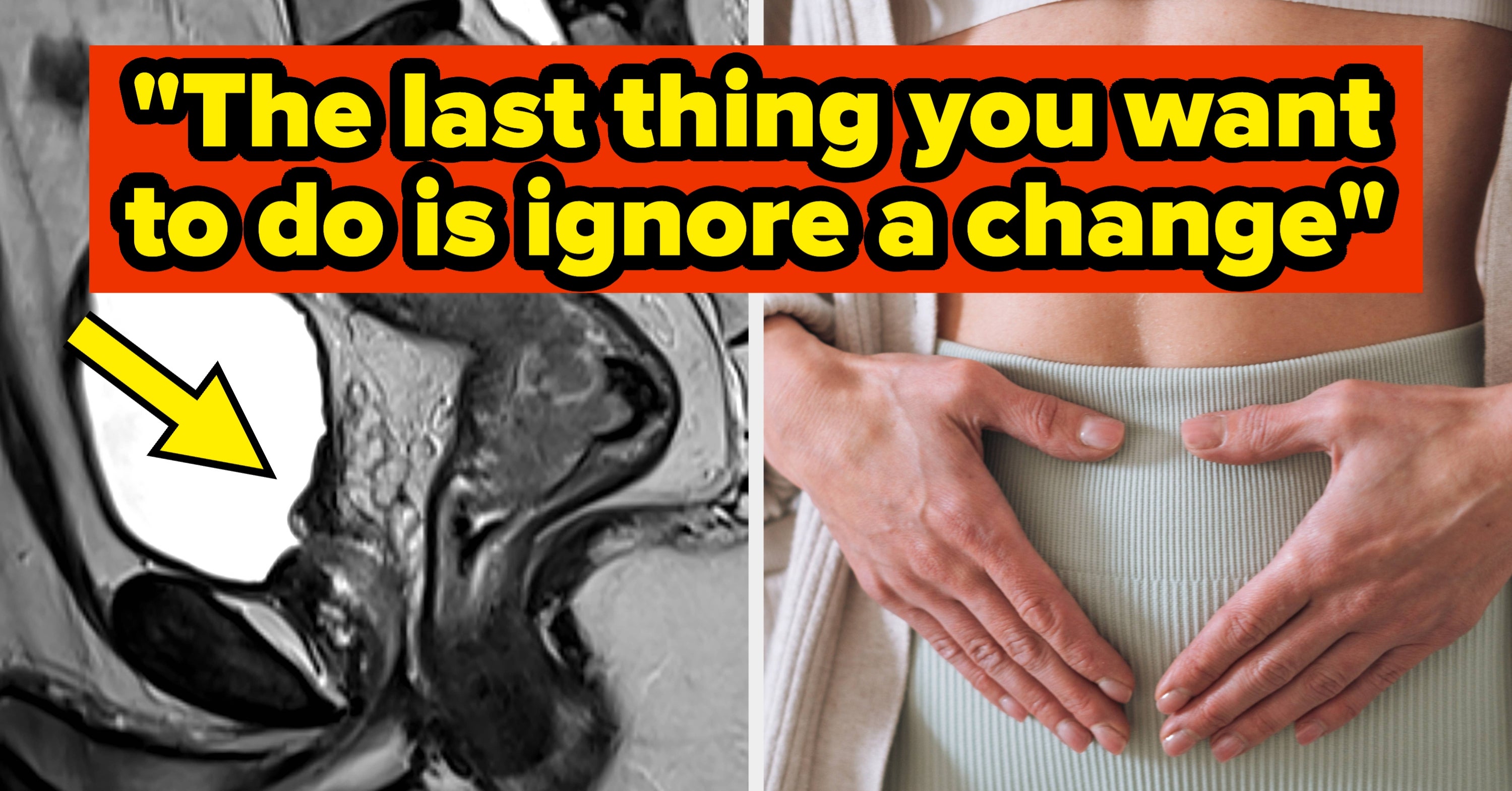 Doctors Warn Against Ignoring Key Colorectal Symptoms as Early-Onset Cancer Cases Rise