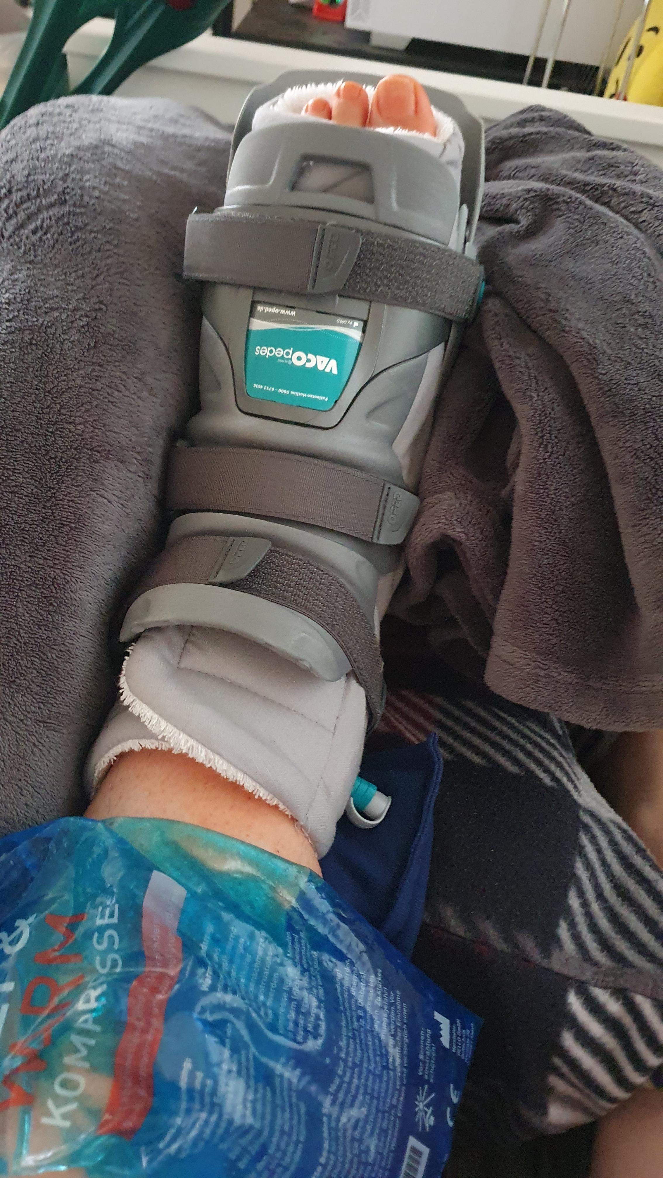 Person's foot in a medical boot, resting on a blanket with an ice pack