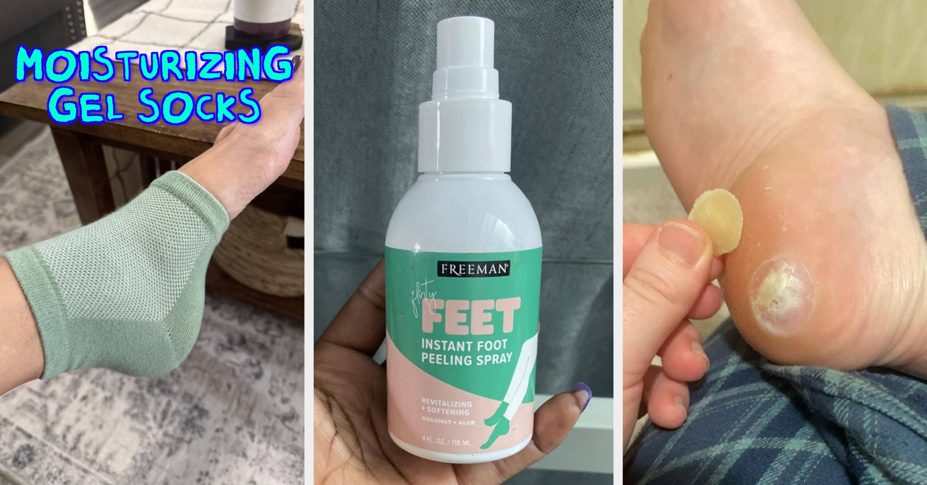 Just 16 Products That'll Help With Calluses