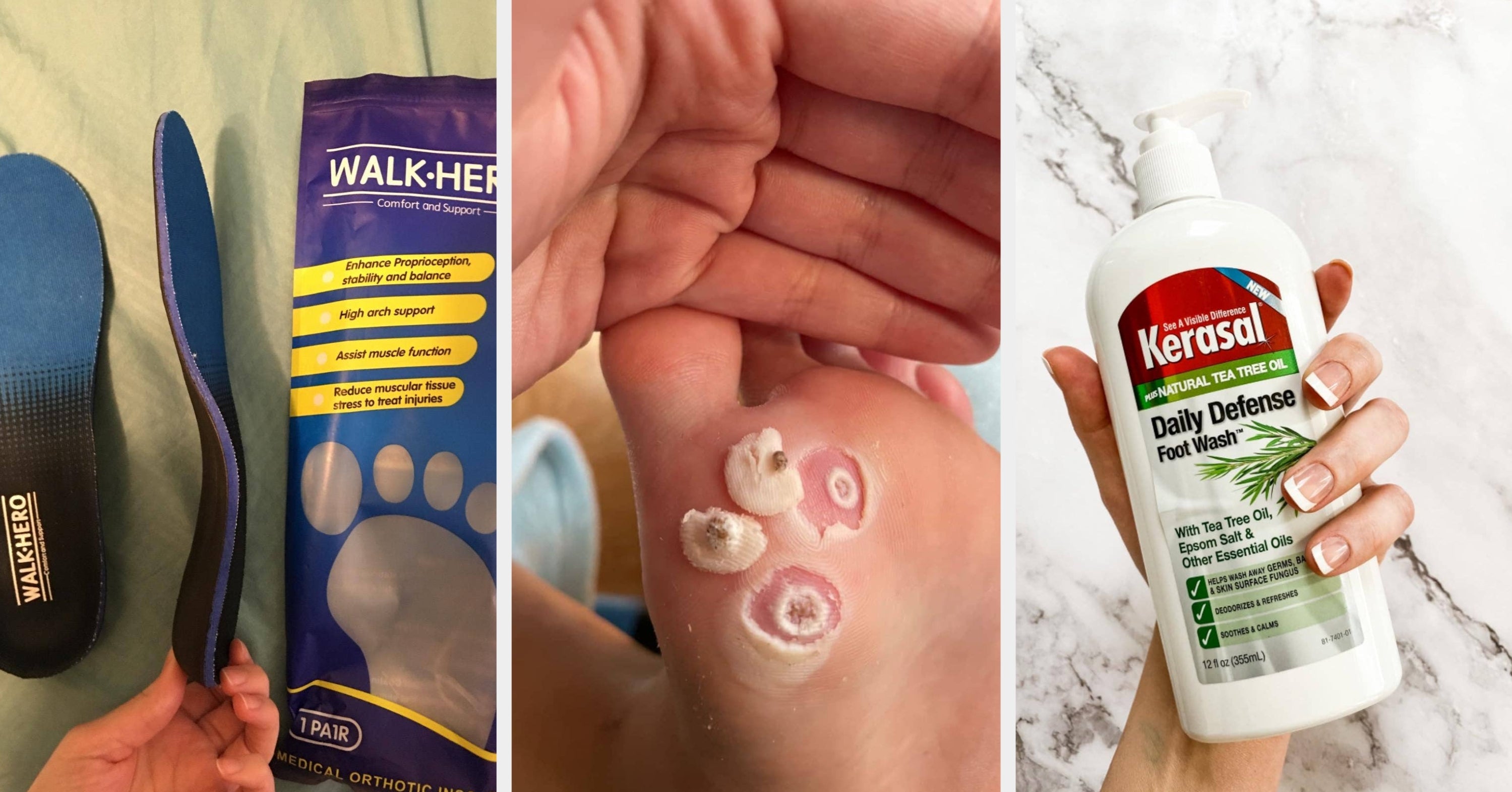 Works Like Magic: 27 Feet Products With Results Pics You Have To See To Believe