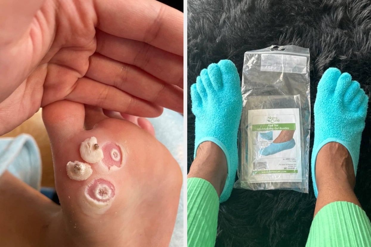 Works Like Magic: 27 Feet Products With Results Pics You Have To See To Believe
