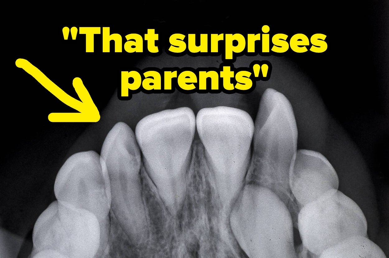 Dental X-ray with text: "That surprises parents" and a yellow arrow pointing to a tooth