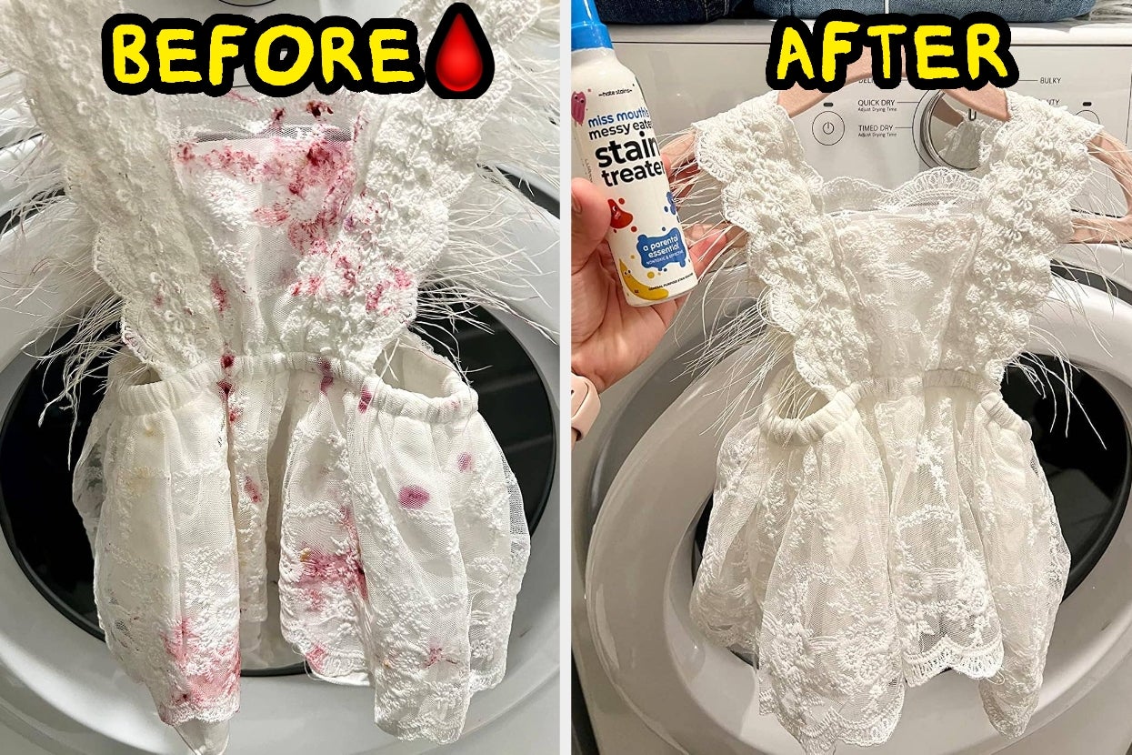 Boo! Just 43 Before And Afters That Are Scary Good