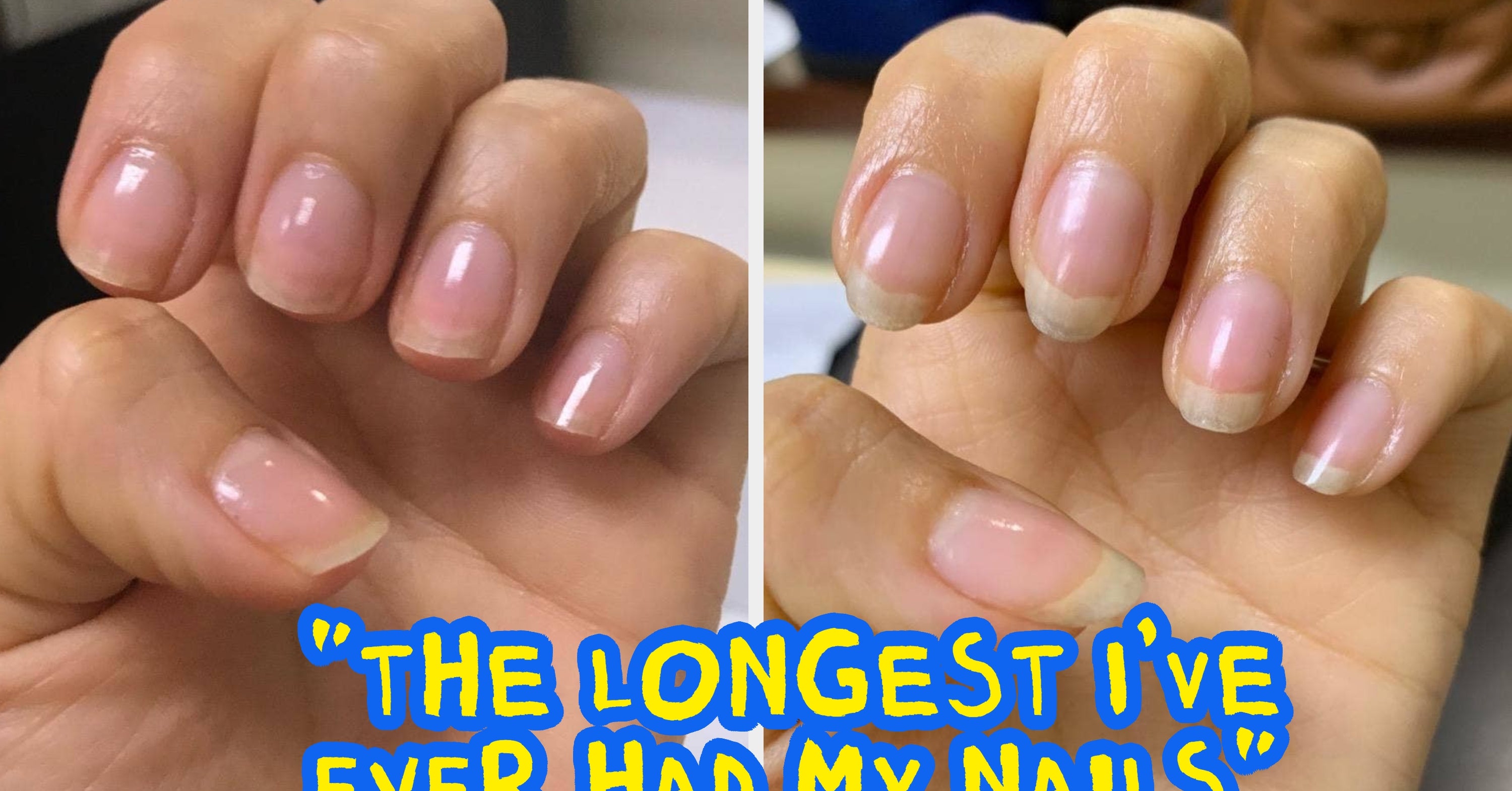 31 Products With Before-And-After Photos That'll Inspire You To Get Your Life Together