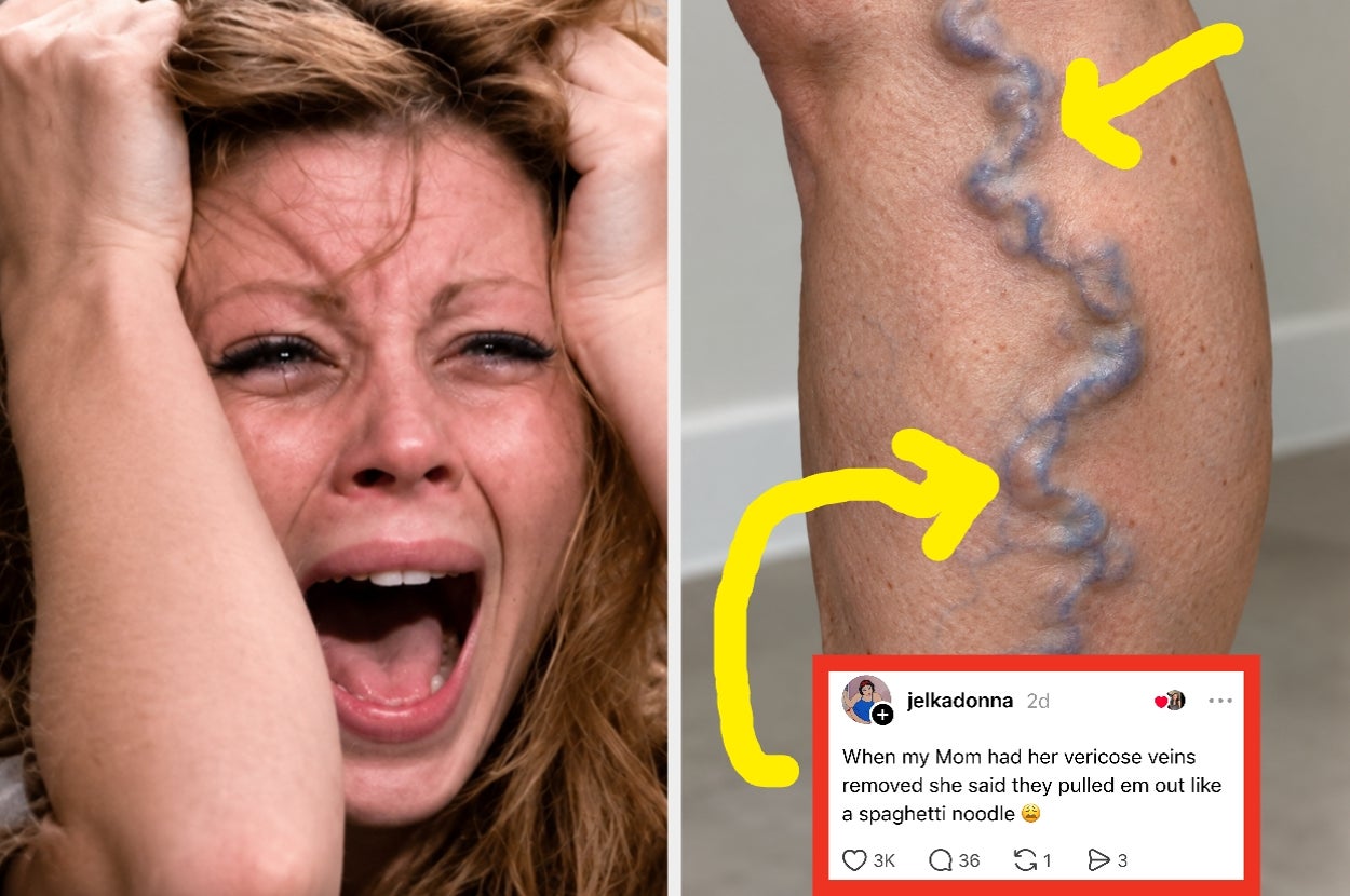 "Someone Tried To Debate Me On This But It Wasn’t Worth My Sagittarius Energy": People Are Losing Their Minds Over These Lesser-Known Human Body Facts That The General Population Probably Doesn't Know But Should