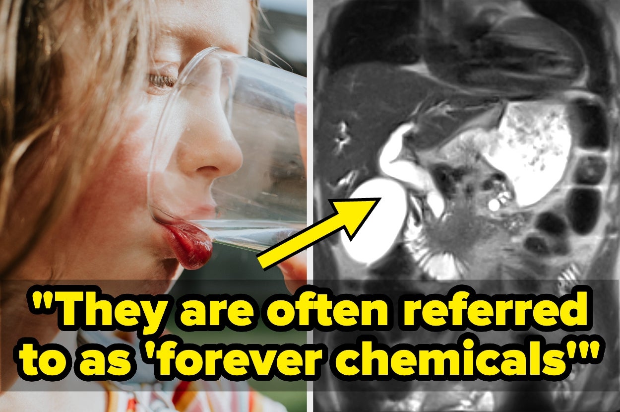 Child drinking water next to an image showing an internal scan of the stomach. Arrow points to scan with text: "They are often referred to as 'forever chemicals'"