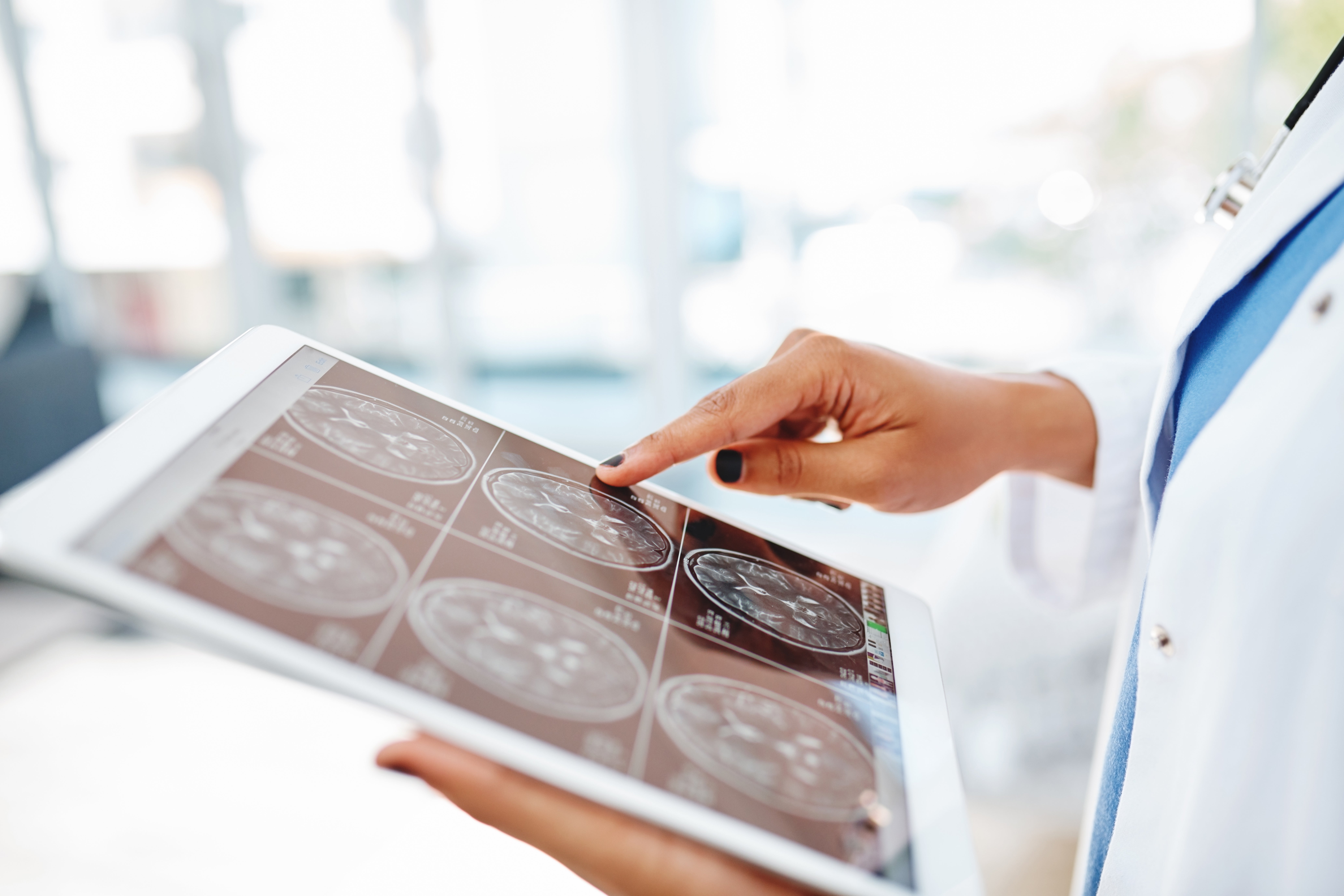 A medical professional examines brain scans on a tablet, focusing on detailed images with a stethoscope visible in the background
