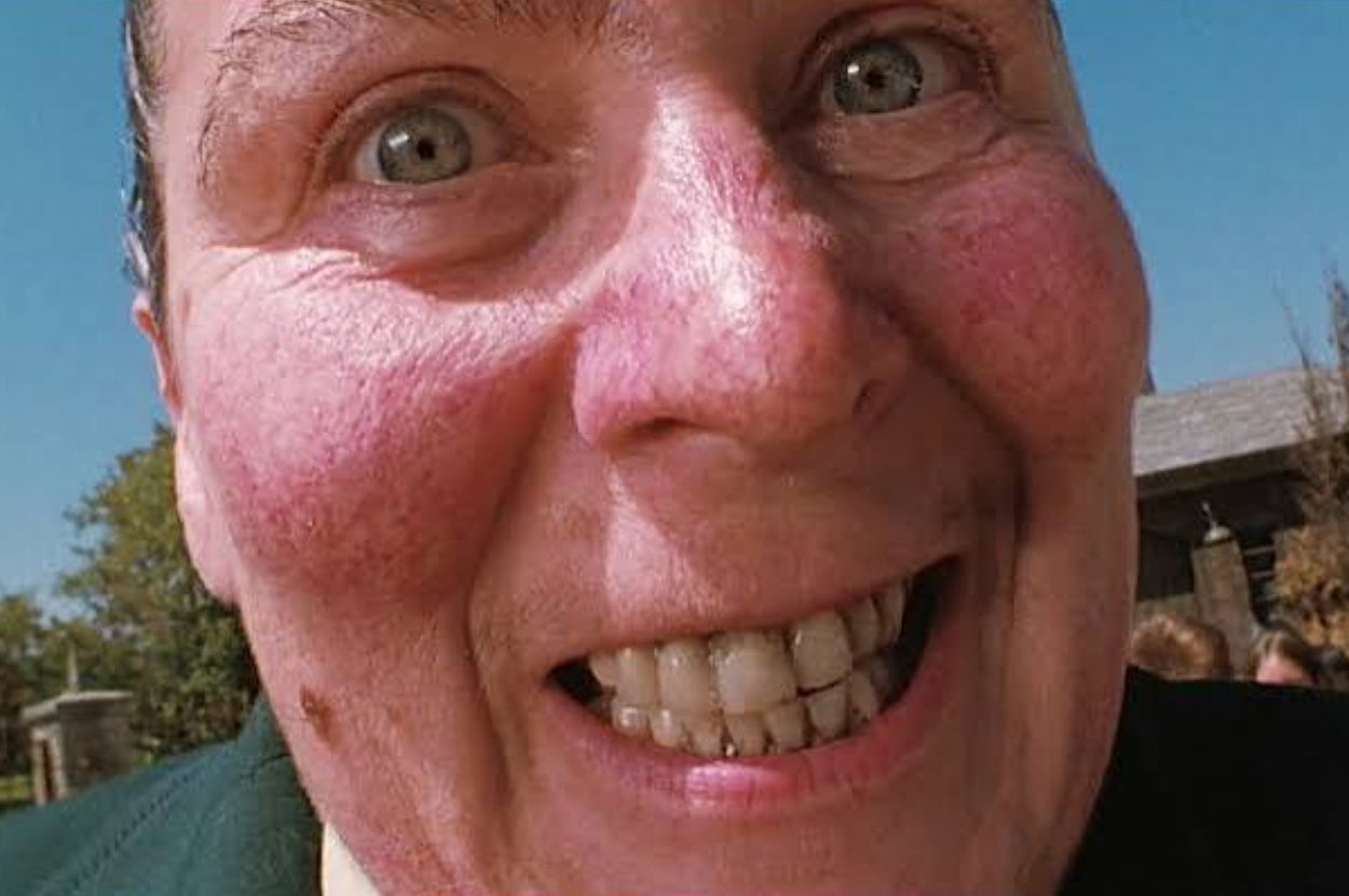 Person with wide eyes and a big smile, close-up of their face. They appear outdoors