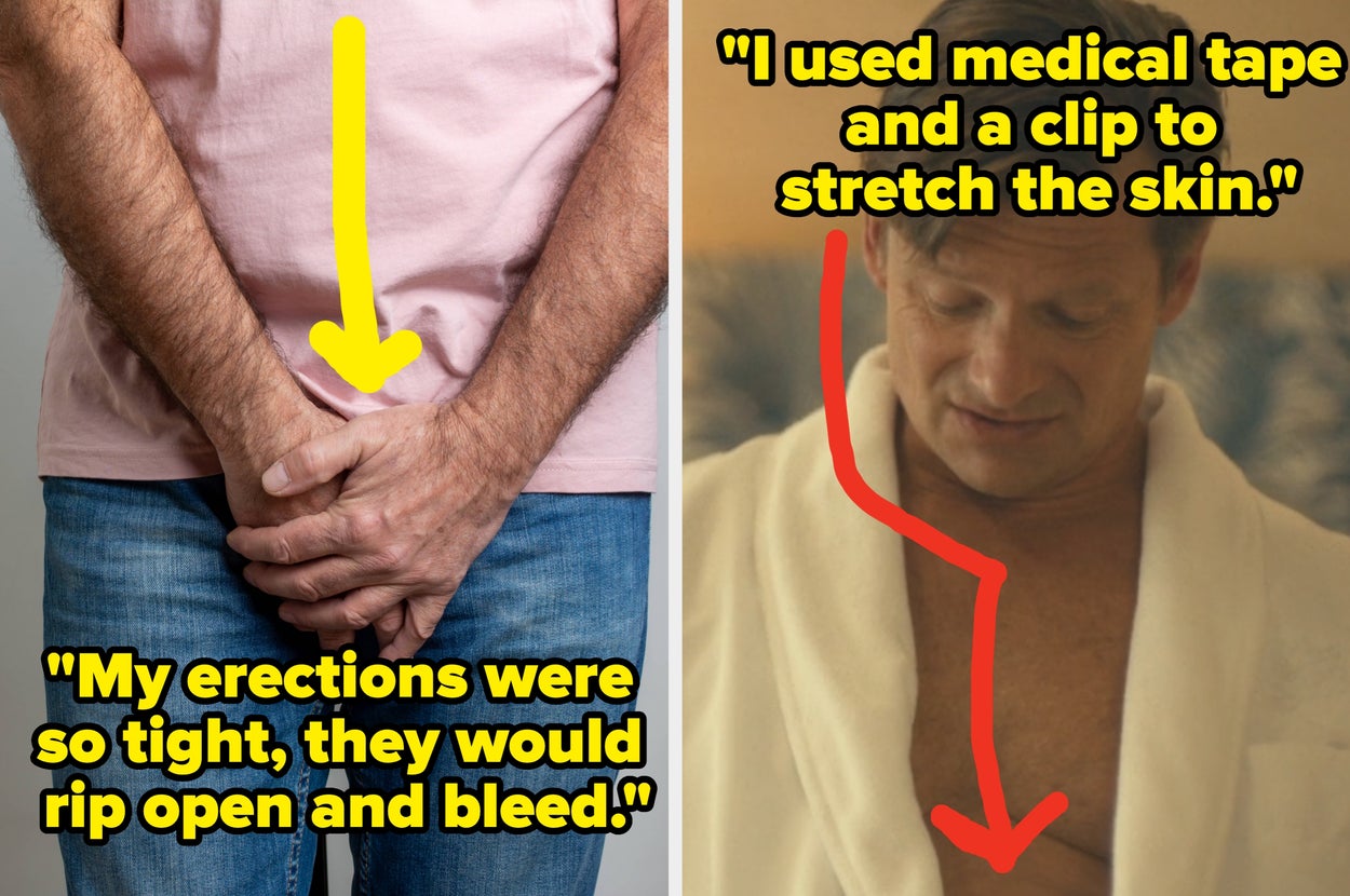 "My Penis No Longer Rips Open." Men Who've Regrown Their Foreskin Are Sharing What It's Actually Like, And It's Fascinating