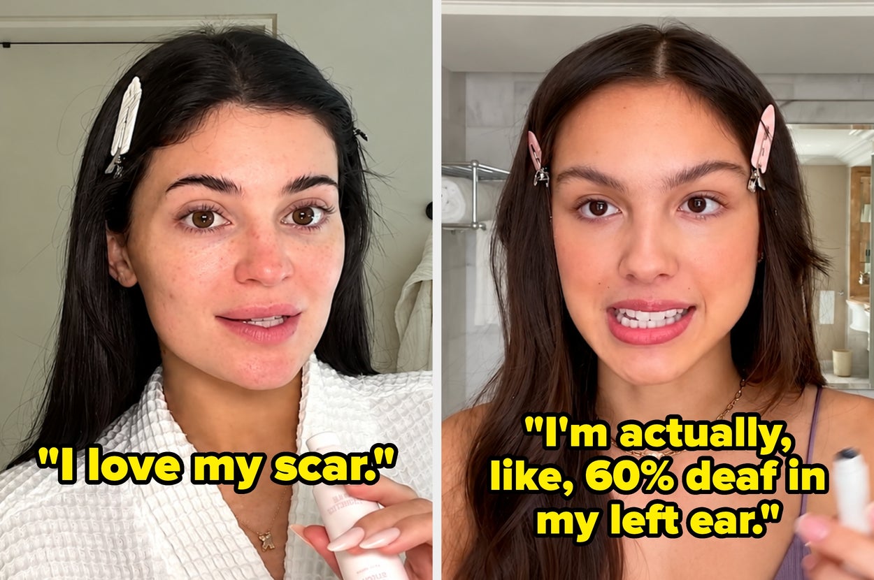 "I Was Born With A Tail": 19 Celebrities Who Revealed Some Truly Bizarre Things About Their Bodies, And I'm Still Processing