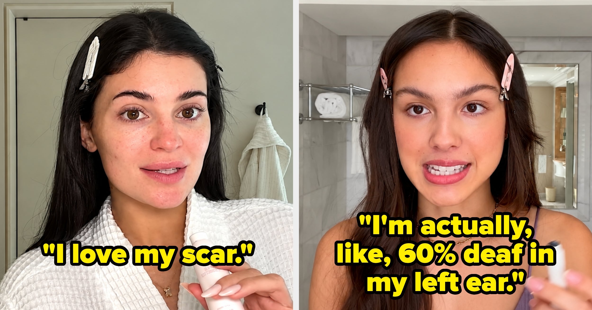 "I Was Born With A Tail": 19 Celebrities Who Revealed Some Truly Bizarre Things About Their Bodies, And I'm Still Processing