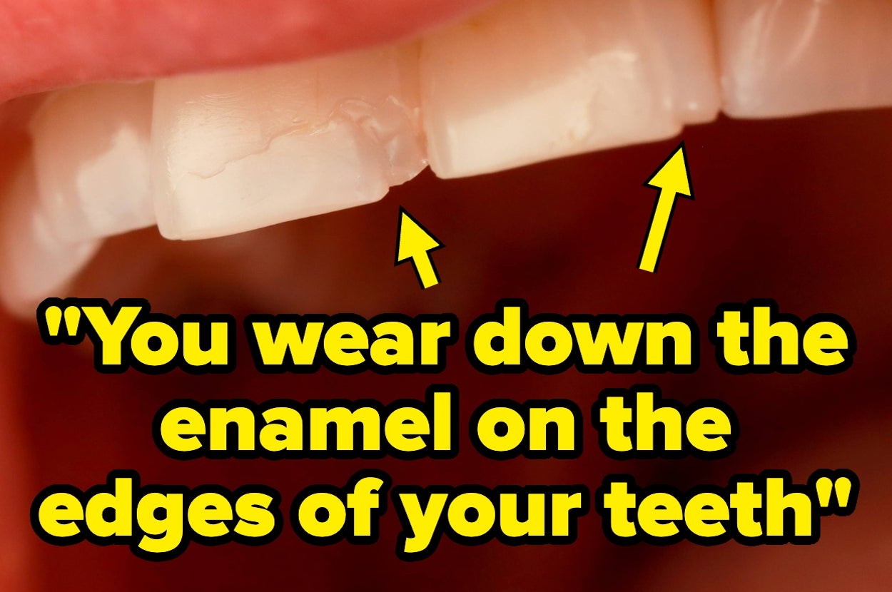 9 Things Dentists Would Never, Ever Do To Their Teeth