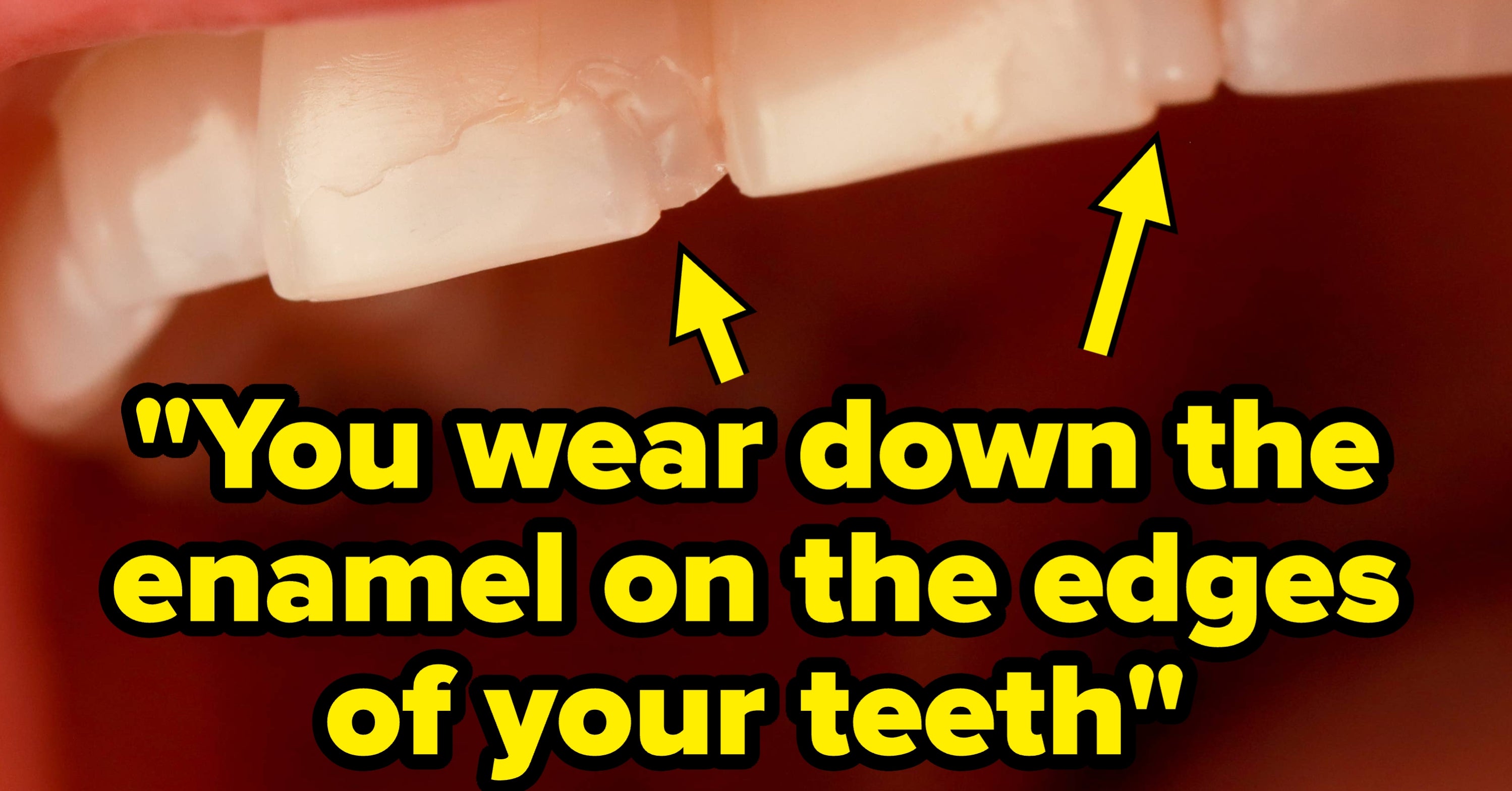 Dentists Are Revealing The 9 Things They Would Never, Ever Do To Their Own Teeth, And Some Of These Had Never Even Occurred To Me Before
