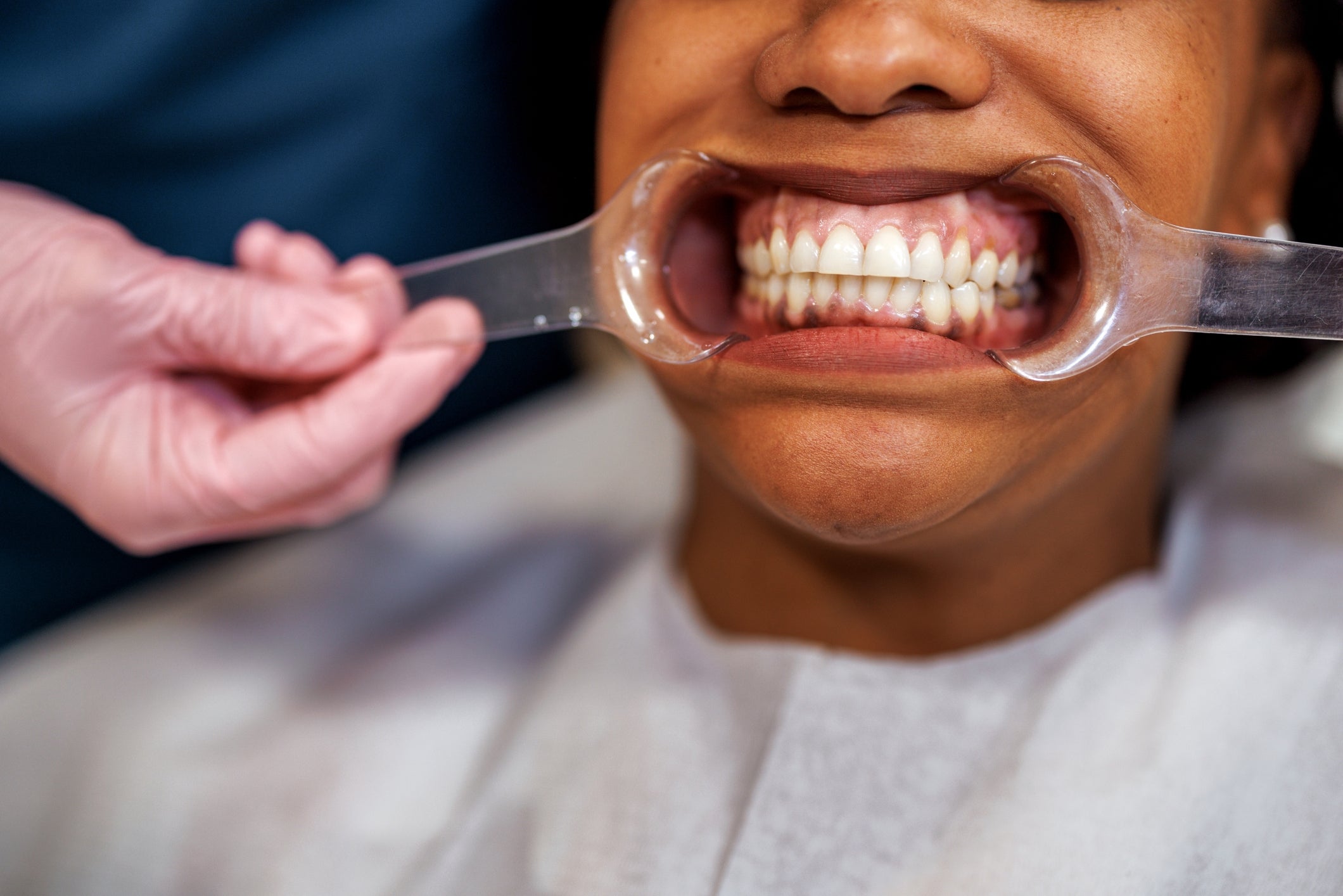 Wisdom Teeth Developing 31 Wild Things Doctors Actually Said To Patients