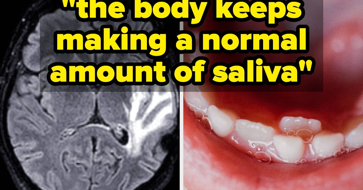 Drooling In Your Sleep Could Actually Be A Big Tell About Your Health, And These Experts Know Exactly What To Watch Out For