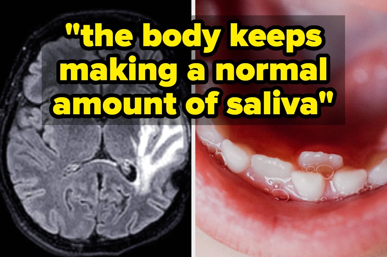Experts Are Explaining When Drooling In Your Sleep Could Be A Sign Of Something More Serious