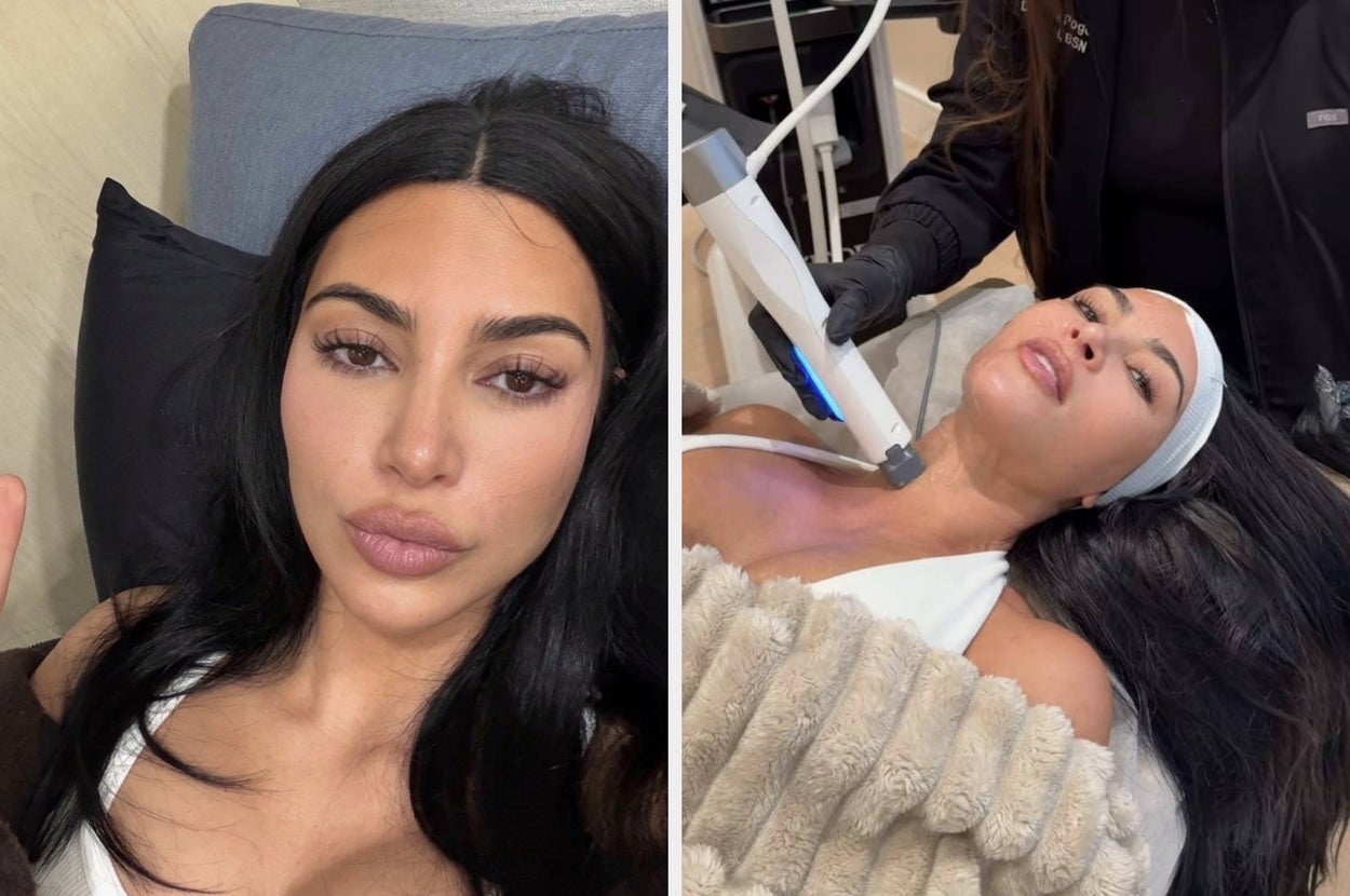 Months After Going Viral For Having A “Whole New Face,” Kim Kardashian Showed What Her Skin Actually Looks Like Following A Wild $2,000 Cosmetic Treatment