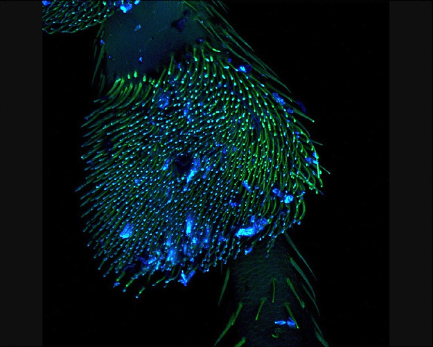 Subject: Section of a Coccinella (ladybug) legPhotographer: Andrea Genre, Department of Life Sciences and Systems Biology, University of Turin, ItalyMagnification: 10x