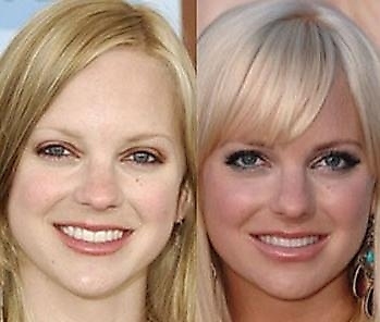 i think her plastic surgery was an improvement. she looks great!