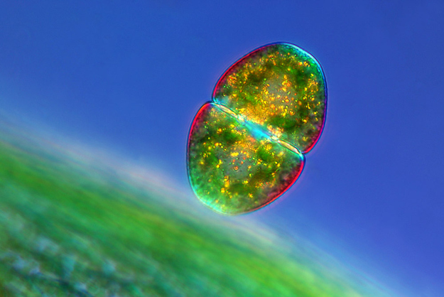 Subject: Cosmarium sp. (desmid) near a Sphagnum sp. leafPhotographer: Marek Mis, Marek Mis Photography, Suwalki, PolandMagnification: 100x