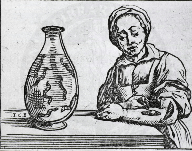 Fever? Chills? Yes, yes. You've got bad blood. Would you prefer blood-letting, leeches, or cupping?