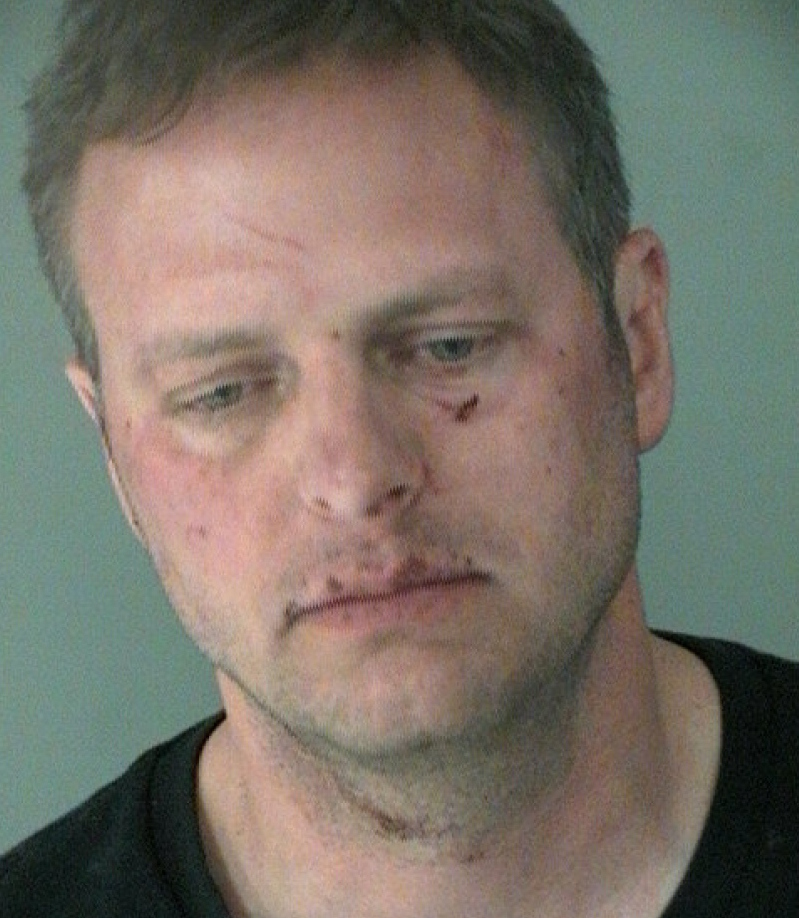 Krusinski, who was reportedly scratched up by his alleged victim, in a mugshot released by the Arlington Police Department.