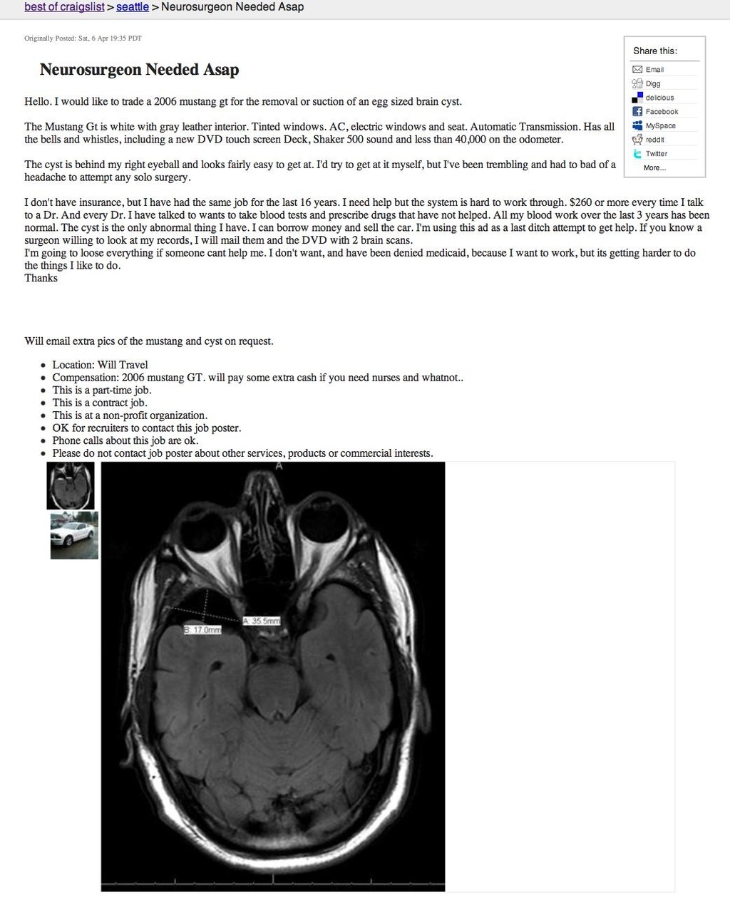 "The cyst is behind my right eyeball and looks fairly easy to get at." Calling all cyst fetish freaks, easy access.