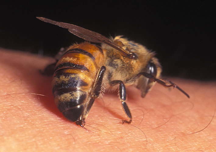 Getting stung by a bee kind of hurts and it is usually something you are not expecting (if you are a person who expects to get stung by a bee then maybe this mitigates the pain to an extent). It is also a reminder that there is no peace and harmony in nature, only hostility and self-preservation.