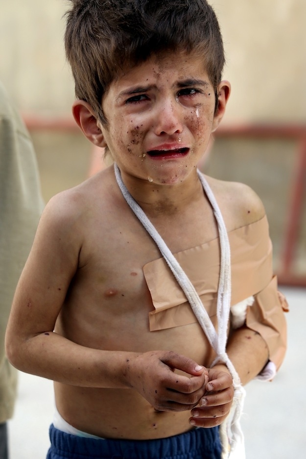 A Syrian girl, Bushra al-Hassan, 4, injured from a government airstrike, cries at Jabal al-Zaweya village of Sarjeh, in Idlib, Syria, Monday, Feb. 25, 2013.