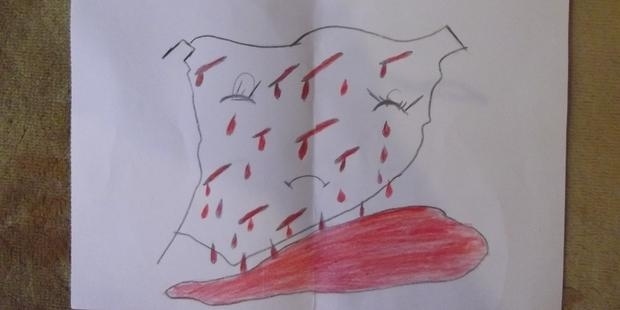 I don't even know what this is, but it is definitely bleeding.