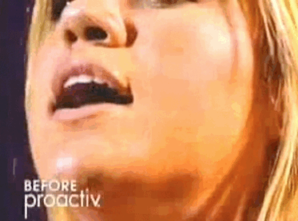 13 Terrible Moments In Celebrity Proactiv Endorsement History