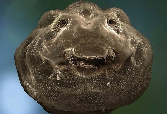 26 Things You Never Want To See Under A Microscope