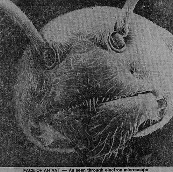 26 Things You Never Want To See Under A Microscope