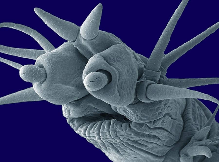 26 Things You Never Want To See Under A Microscope