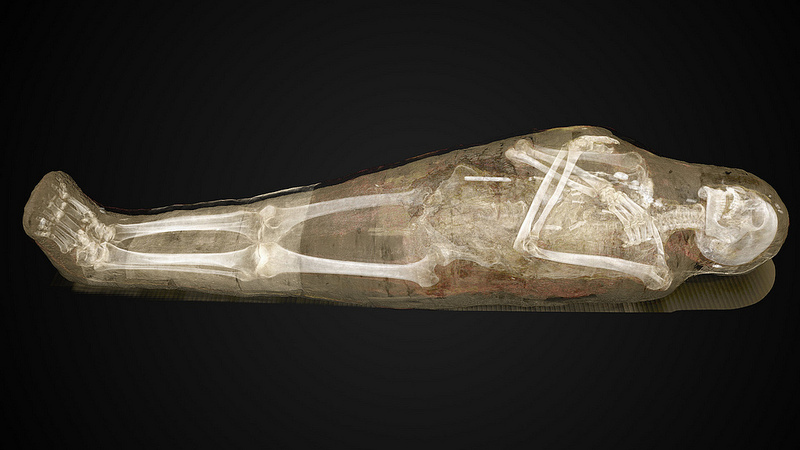 Early visualization of CT scan - forensic experts scanned each mummy using state-of-the-art dual energy Computer Tomography (CT)