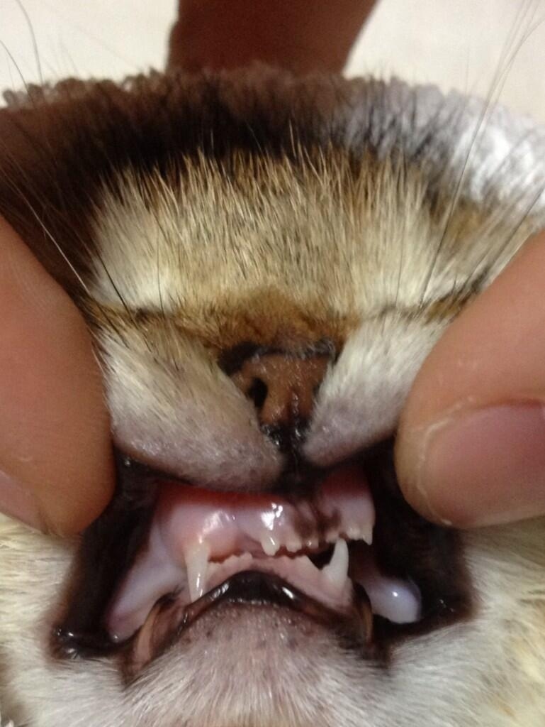 07-11-2013@jessiepon “...Her upper chin is slightly off to left because of the bone fracture, and the lower chin is shifted to right.”