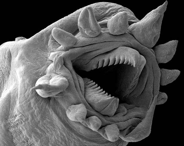 26 Things You Never Want To See Under A Microscope
