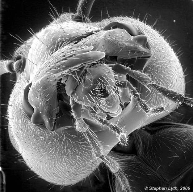 26 Things You Never Want To See Under A Microscope
