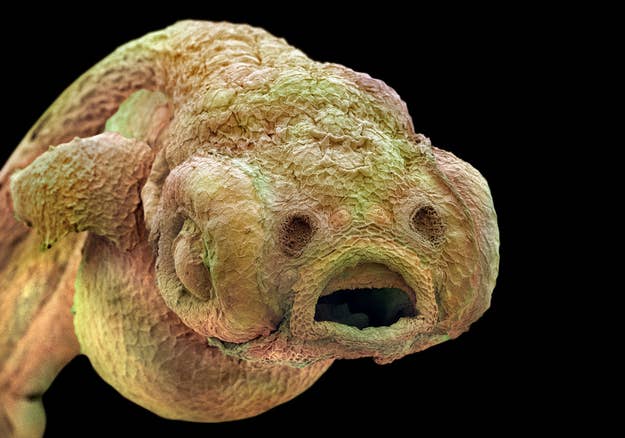 26 Things You Never Want To See Under A Microscope