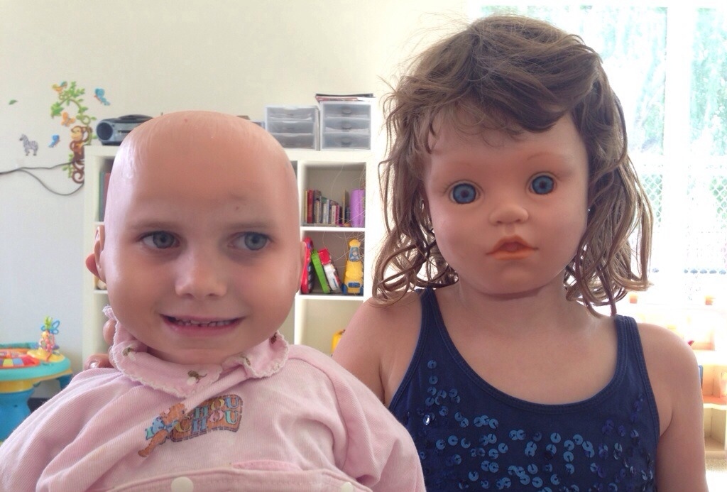 Синдром счастливой куклы фото детей