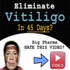 vitiligo-miracle-review