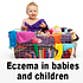 eczemainchildren profile picture