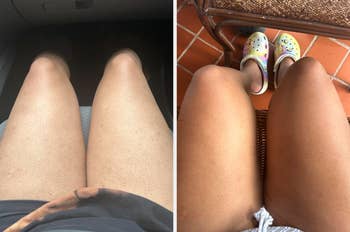 Two photos of bare legs: left in a car, right on a chair wearing colorful Crocs with holes, showcasing smooth skin texture