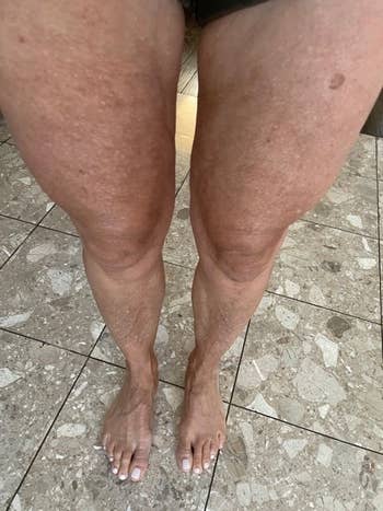 same reviewer's legs after using the cream, looking visibly tighter and smoother