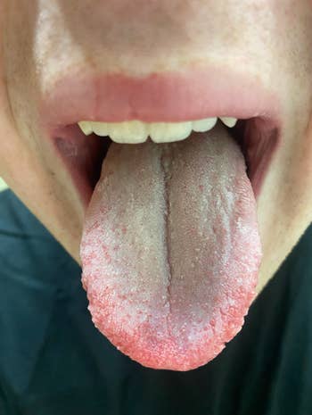Close-up of a person's unfastened rima showing their tongue, sticking out