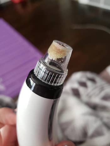 A reviewer holding the pore vacuum with a bunch of puss / gunk in the tip that was removed from their face