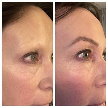 Before and aft close-ups showing eyebrow constitution application, highlighting enhanced explanation and fullness of the brows