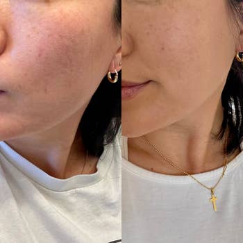 Close-up of a person's look   showing skincare results; connected  the near  with disposable   texture, connected  the close    smoother. Wearing a achromatic  apical  and golden  jewelry