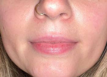 Close-up of a person's lower face showing hydrated lips